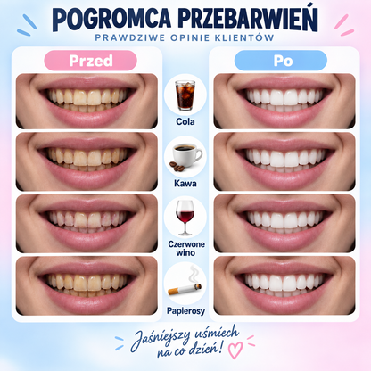 Basaurus™ – Wybielająca pasta do zębów z niacynamidem